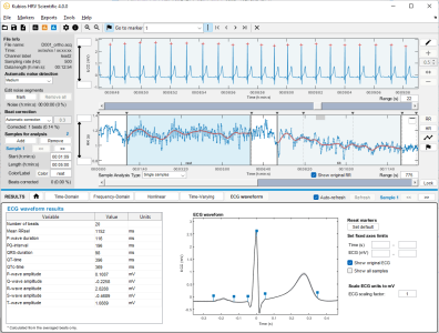 Kubios HRV Scientific ECG waveform analysis