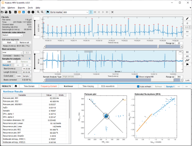 Kubios HRV Scientific handling ectopic beats