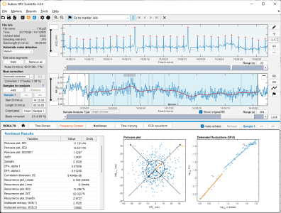 Kubios HRV Scientific handling ectopic beats