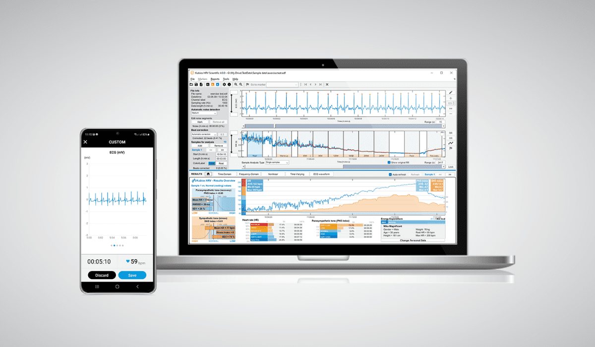 Introducing Kubios HRV Scientific 4.0 - Heart rate variability analysis software
