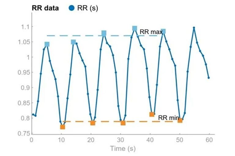 Kubios HRV - Heart rate variability software for scientific research