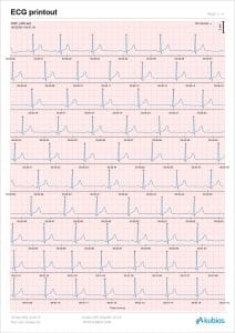 Kubios HRV Scientific ECG printout