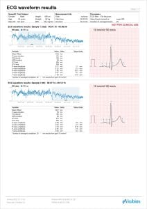 Kubios HRV Scientific ECG waveform report