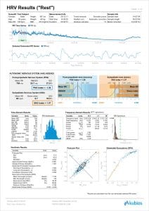 Kubios HRV Scientific - Heart rate variability analysis report