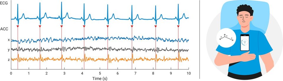 Seismocardiography or ballistocardiography, measurement of accelerometer-based heart rate variability (HRV)