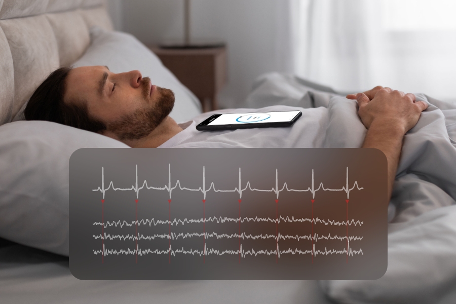 Accuracy of smartphone-based SCG for HRV analysis and readiness measurement