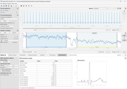 Kubios HRV Scientific and ECG waveform analysis