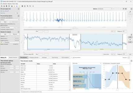 Kubios HRV Scientific time-domain HRV parameters