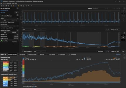Kubios HRV Scientific user interface (dark theme)