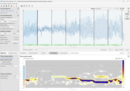 Kubios HRV Scientific and time-varying spectrum estimation for HRV data